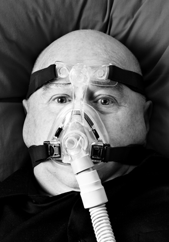 Cannot tolerate CPAP - needs alternative treatment