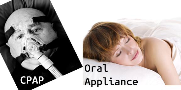 Choice of treatment: CPAP or Oral Appliance